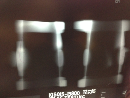 X-ray to inspect the throttle body 1